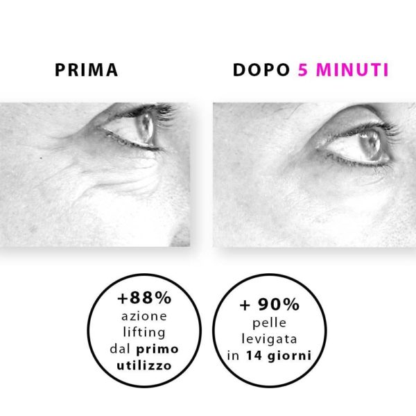 NOVEXPERT ACIDO IALURONICO SIERO LIFTING (fuori produzione) - immagine 3